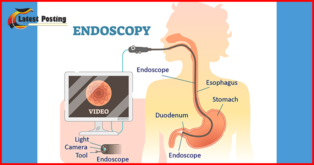 Endoscopy