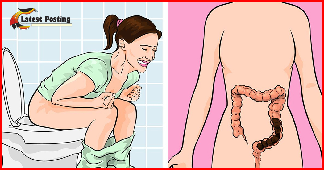 Constipation