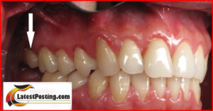 Teeth